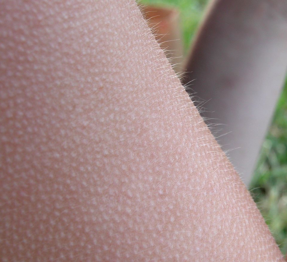 Goosebumps appear with cold and strong feelings