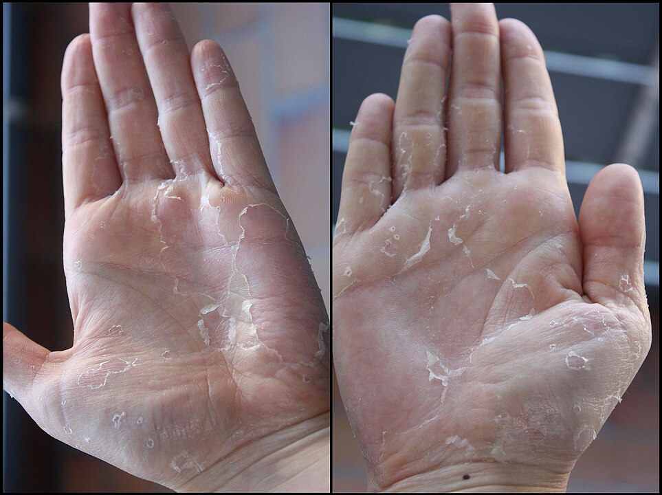 Humans Shed Millions of Skin Cells Daily