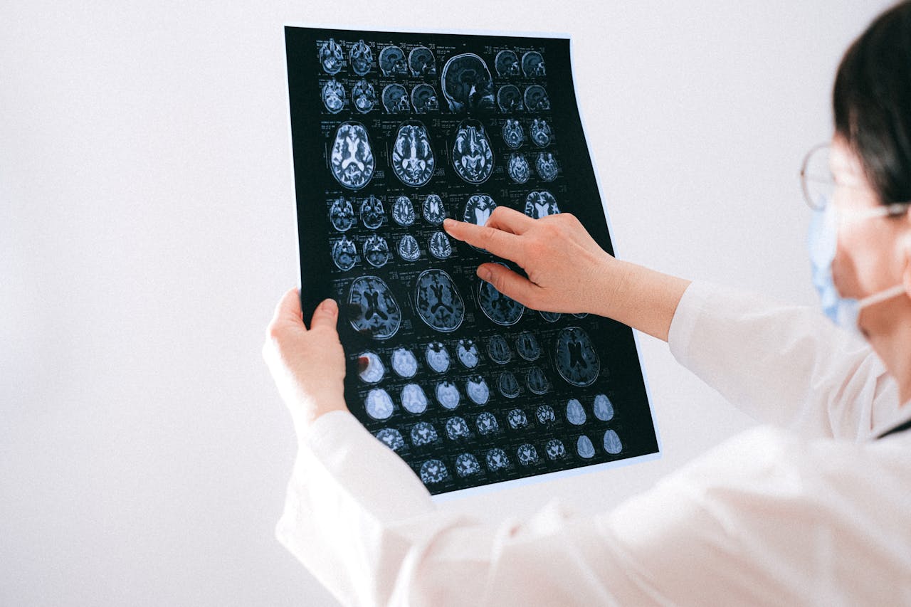 Your Brain Uses About 20 Percent of Your Energy