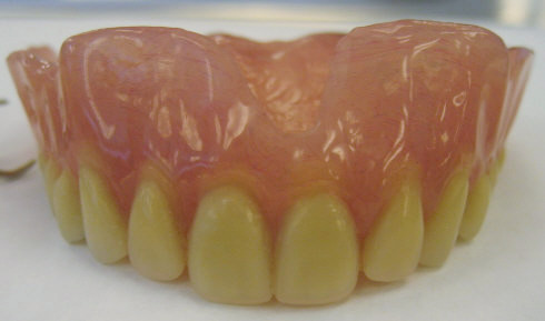 False teeth