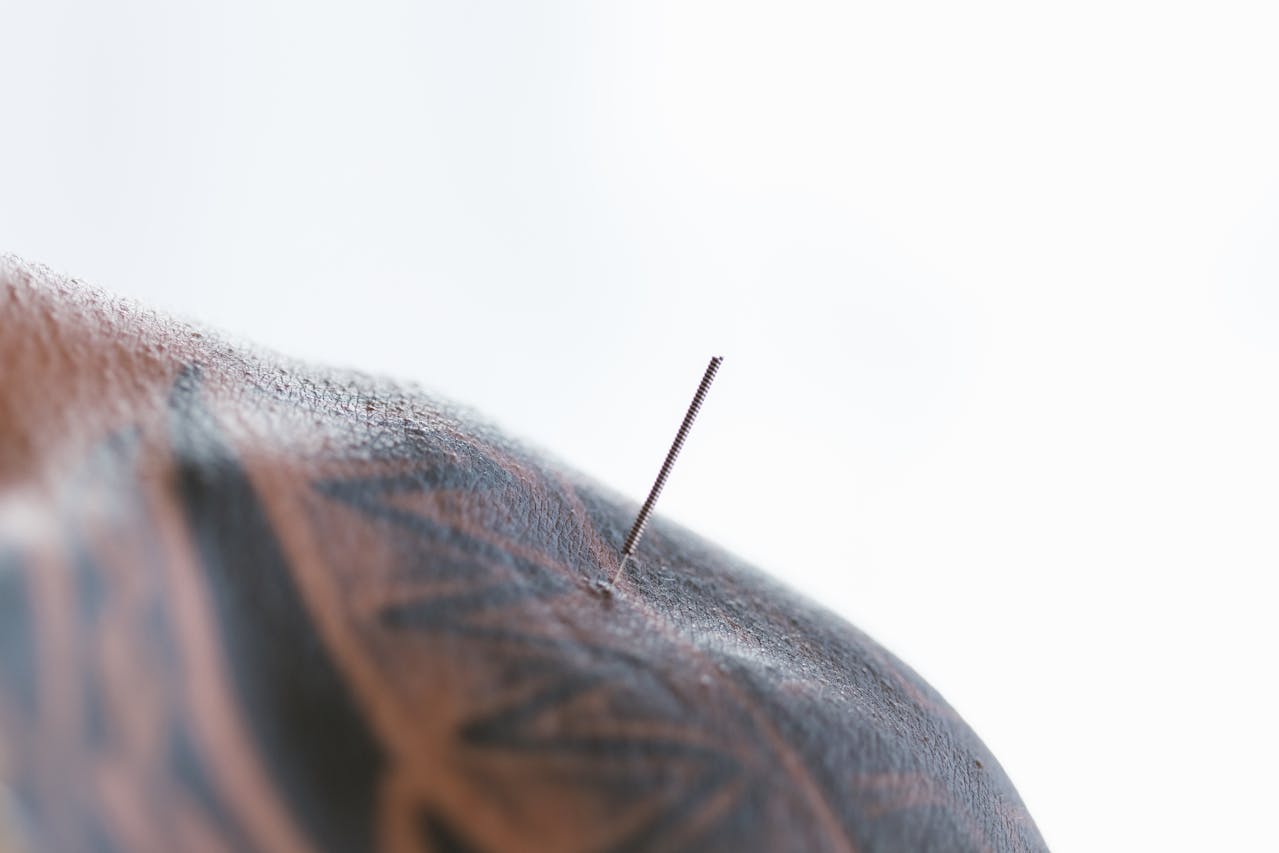 Acupuncture Needling